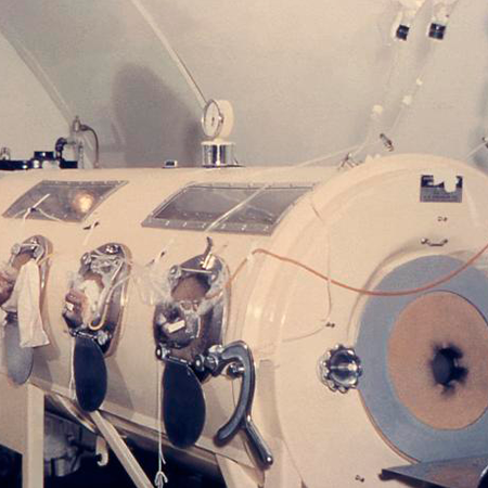 «Железные легкие». Полиомиелит